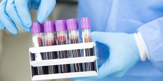 New lab tests to help vegans track health